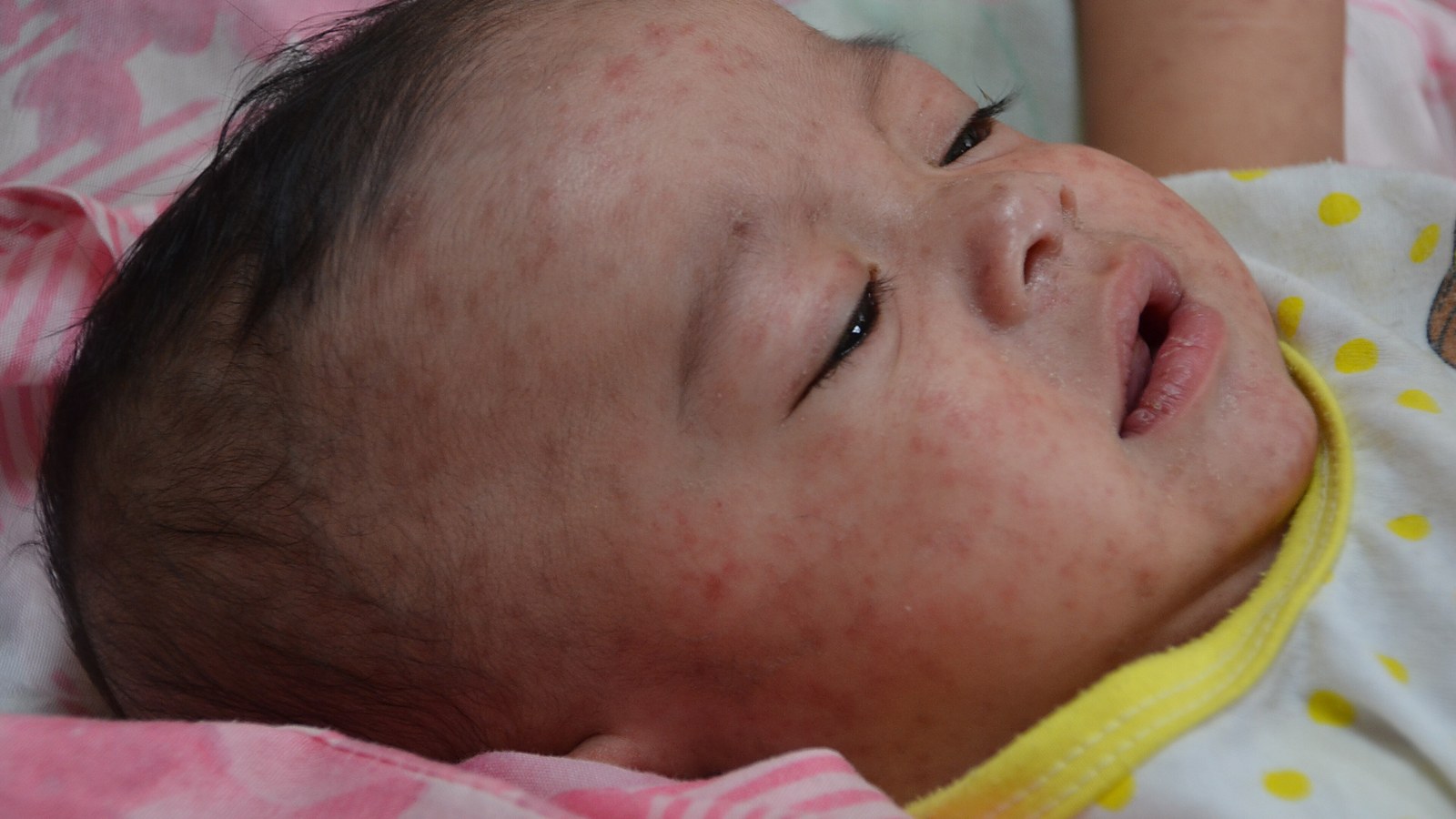 Bangladesh's measles death toll passes 1,000 children with nearly 190,000 infections, after an emergency vaccination drive missed roughly four million kids